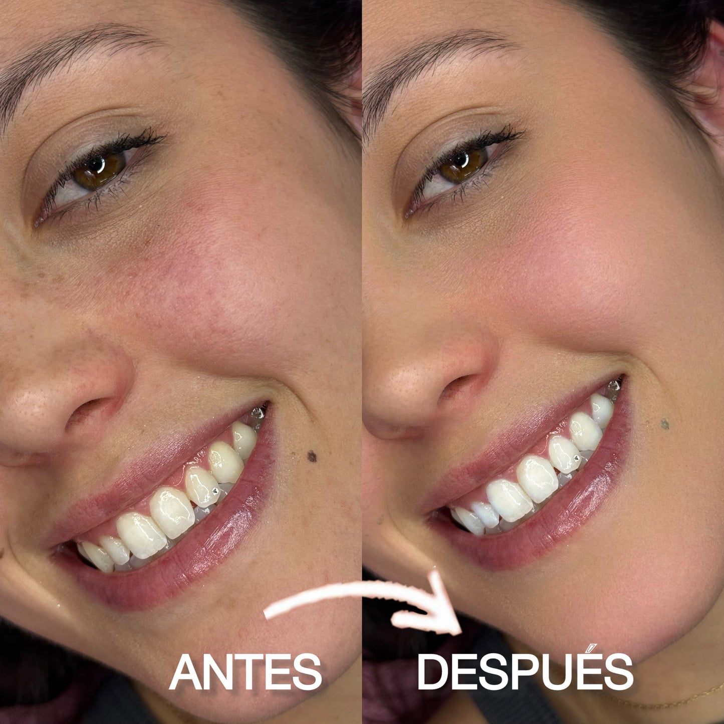 TOOTHGEMS PRO| Domina el ángulo perfecto y retoca como una experta